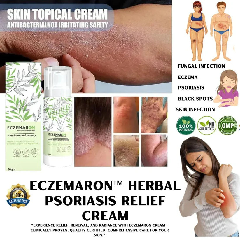 Eczemaron Anti Fungal Cream 50gm | Buy 1 Get 1 Free|  (4.9/5.0⭐⭐⭐⭐⭐)